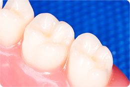 王子神谷・東十条・さわべ歯科クリニック王子神谷・乳歯のむし歯は永久歯にも影響