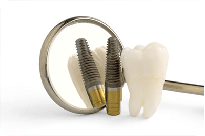 王子神谷・東十条・さわべ歯科クリニック王子神谷・その他の不具合