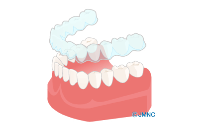 王子神谷・東十条・さわべ歯科クリニック王子神谷・マウスピース矯正