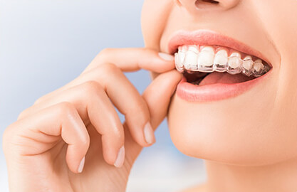 マウスピース作製